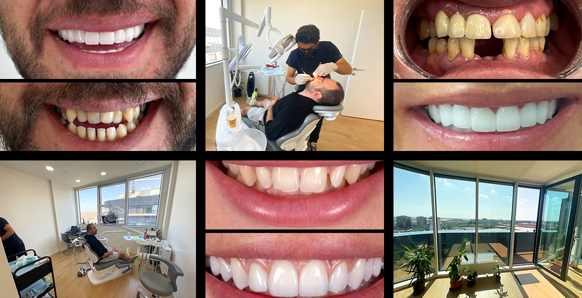 Zahnbehandlungen und Ästhetik