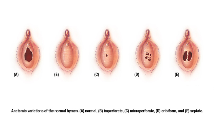 What is the Hymen